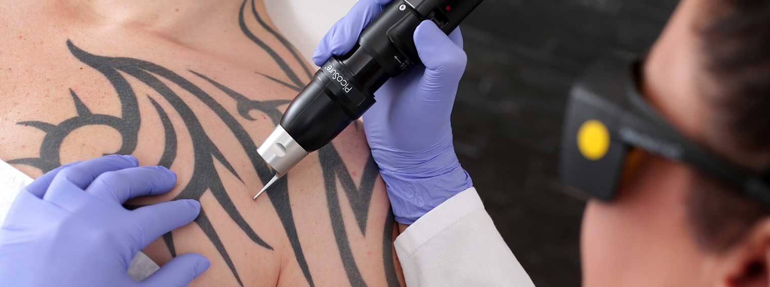 Picosure Tattoo Removal Dublin Dundrum Cosmetic Clinic Dundrum