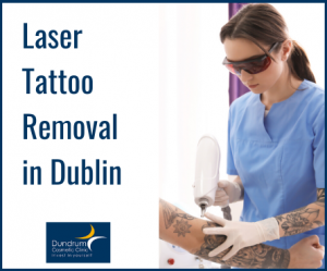 Laser Tattoo Removal Dublin