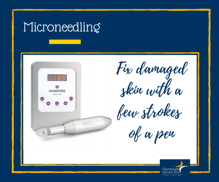 microneedling in Dublin