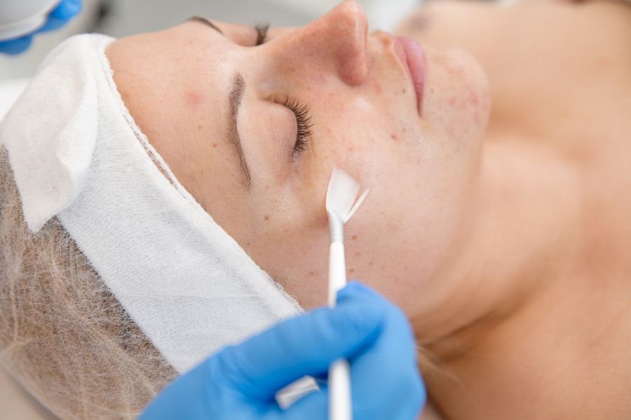 hyperpigmentation treatment dublin